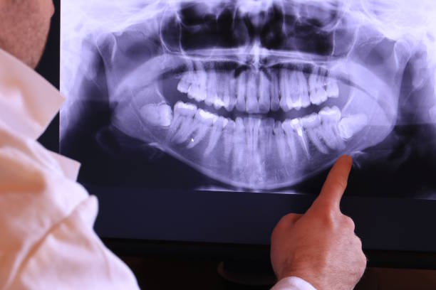 Best Emergency Root Canal Treatment in Olathe, CO